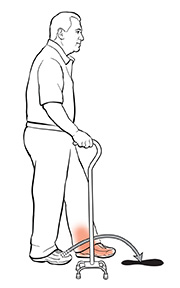 Side view of man using a quad cane. The arrow shows where he should put his foot.