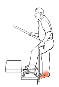 Side view of a man using a cane on stairs. The arrows show where he should put his cane and injured foot to move up the stairs.