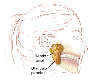 Vista lateral de una cabeza de mujer en la que se muestra la glándula parótida y el nervio facial junto al oído y sobre la mandíbula.