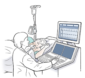Mujer acostada de lado sobre una mesa de examen con cables de electrocardiograma en el pecho. Una técnica sostiene una sonda de ecografía sobre el pecho de la mujer.