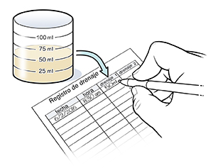 Primer plano de una mano anotando mediciones de líquidos en un registro.