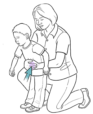 Woman doing choking rescue maneuver on conscious toddler.